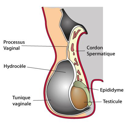 Pathologies des bourses à Lyon | CUB - Centre d'Urologie Bellecour ...