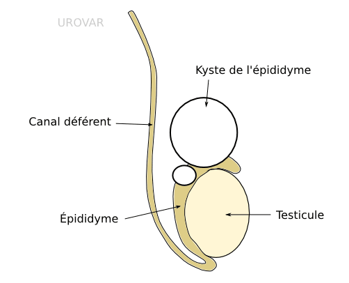 Pathologies des bourses à Lyon | CUB - Centre d'Urologie Bellecour ...